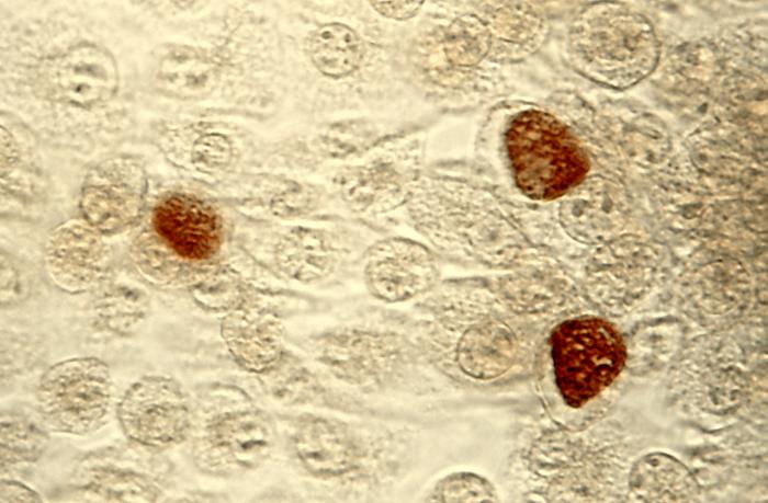 Chlamydia-Trachomatis-la-benh-gi-1