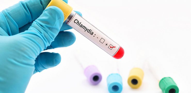 duong-tinh-voi-chlamydia